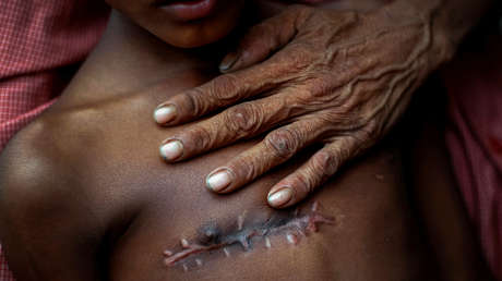 Desgarradoras imágenes: El reportaje que ganó el premio Pulitzer 