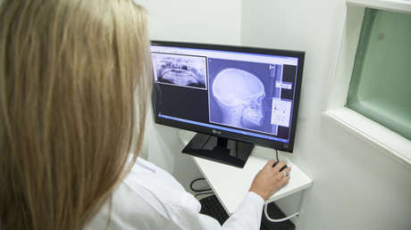 FOTO: Un indio sobrevive a una llave de cuatro centímetros incrustada en la cabeza