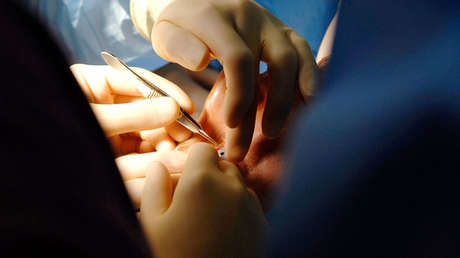 Médicos israelíes devuelven la vista a una paciente ciega trasplantando su diente en el ojo