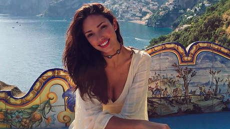 "Masacrada": Una modelo de Victoria's Secret publica fotos tras ser picada por chinches en un hotel