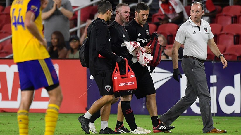 VIDEO, FOTO: Wayne Rooney marca un gol en la MLS de EE.UU. y acaba con la nariz rota