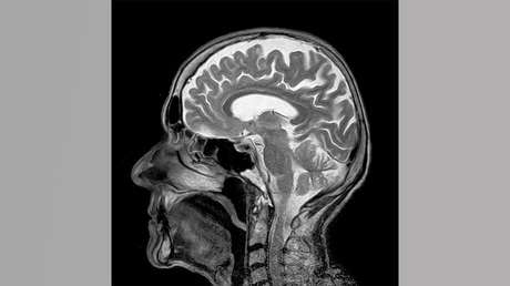 Presentan el primer medicamento que muestra tendencia positiva en pacientes con alzhéimer