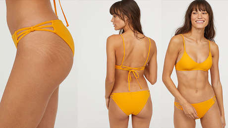 H&M, primera gran cadena de moda en mostrar imperfecciones sobre la piel de sus modelos