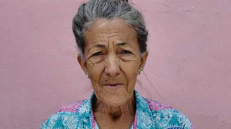 Un descubrimiento "sin precedentes" logra revertir las arrugas y la caída del pelo en ratones