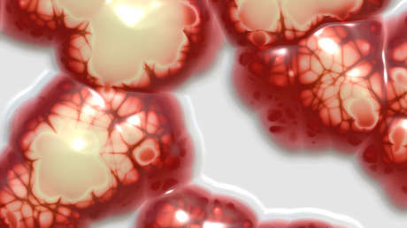 Hallan 100 huevos de tenia en el cerebro de una niña de 8 años que sufría dolores de cabeza