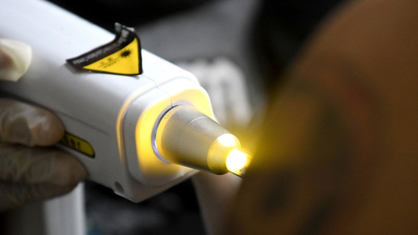 VIDEO: Decide quitarse un tatuaje con las iniciales de su exesposa y obtiene un terrible resultado