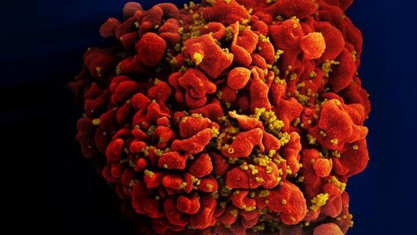 Hallan una combinación de anticuerpos que suprime el VIH durante meses