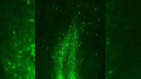 FOTO: Captan una 'explosión' de impulsos neuronales causados por el virus de la rabia