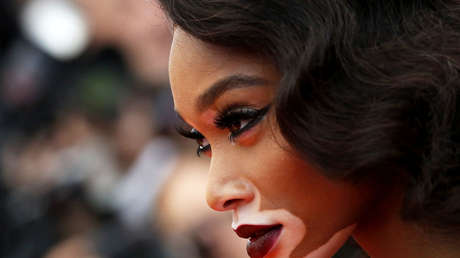 VIDEO: La sincera alegría de una modelo con vitíligo al ser elegida 'ángel' de Victoria's Secret