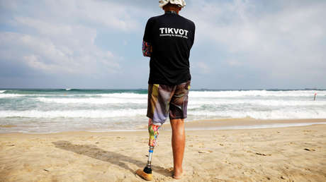 Ofrecen una explicación a la aparición de 'miembros fantasma' tras una amputación