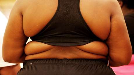 La obesidad pronto matará a más personas que el hábito de fumar