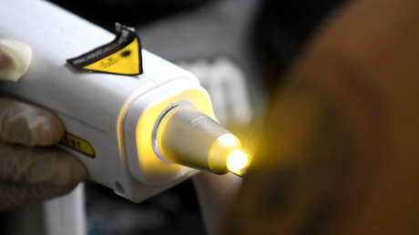 VIDEO: Decide quitarse un tatuaje con las iniciales de su exesposa y obtiene un terrible resultado