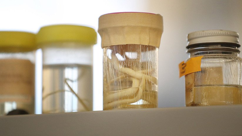 Sentía dolor en el ojo y le extraen vivo un gusano de 15 centímetros