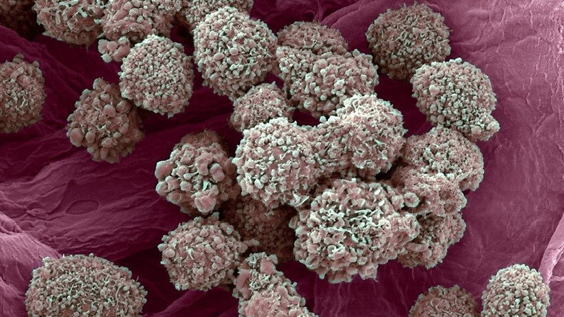 Descubren un nuevo tratamiento contra el cáncer de mama