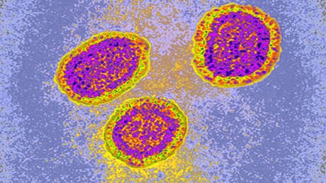 Una pandemia de gripe está a la vista y estos son los grupos más vulnerables