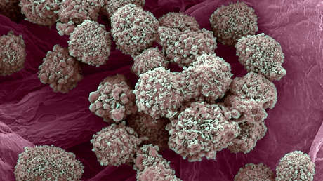 Descubren un nuevo tratamiento contra el cáncer de mama