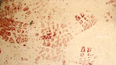 Médicos publican fotos 'ensangrentadas' tras operar a víctimas de tiroteos en protesta contra armas