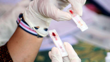 OMS: Rusia fue el país de Europa donde se registraron más infecciones de VIH en 2017