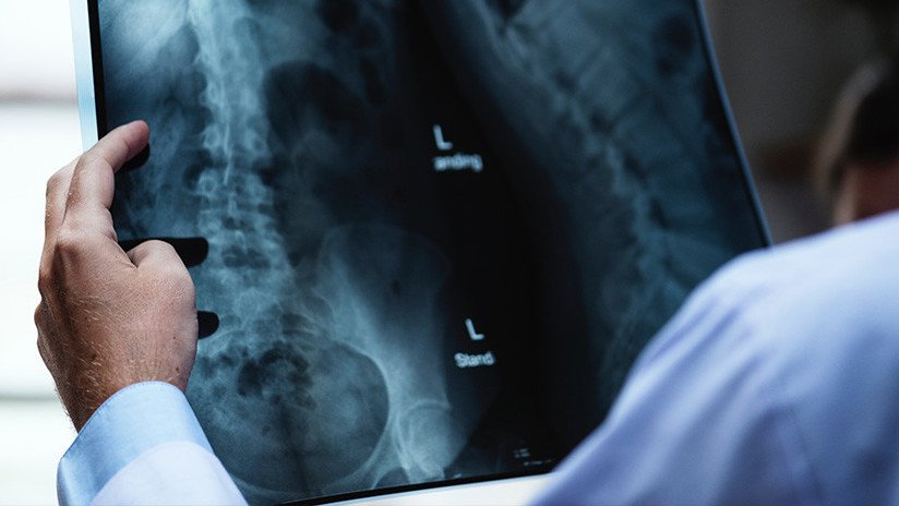 Juguetes, crayones, bolas de golf y otros objetos 'olvidados' por pacientes dentro de sus cuerpos