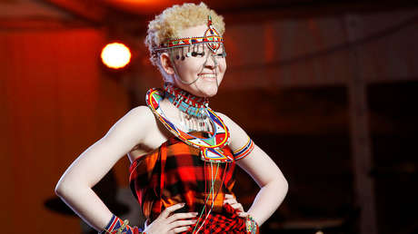 Los albinos: La otra cara de África, que vive estigmatizada por las supersticiones