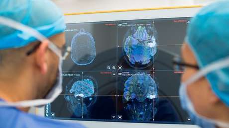 VIDEO: Le perforan el cráneo para extirparle un tumor mientras toca la guitarra en el quirófano