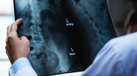 Juguetes, crayones, bolas de golf y otros objetos 'olvidados' por pacientes dentro de sus cuerpos