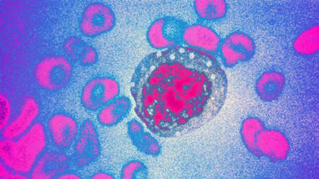 El brote de hantavirus persiste en Argentina: Ya suman 31 casos en la Patagonia