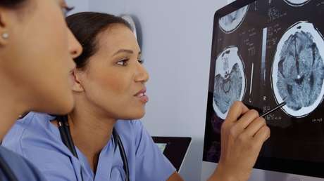 Pensaba que tenía celos de su novio pero era una rara enfermedad cerebral que la volvió psicótica