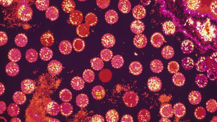 Una científica mexicana descubre la cura para eliminar al 100 % los virus del papiloma humano