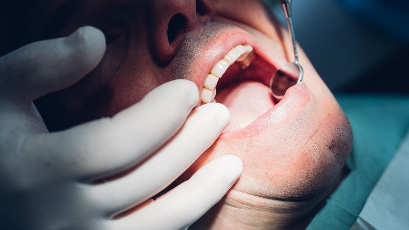 "Me arruinó la vida": Pierde los dientes tras tomar 6 latas diarias de una bebida energética durante meses