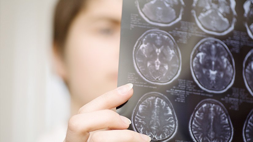 "Como si hicieran la ola": Descubren una forma extraña y nunca vista de conexión entre neuronas 