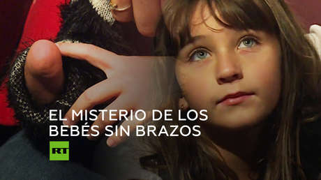 Nacimiento de niños sin brazos: misterio sin resolver en Francia