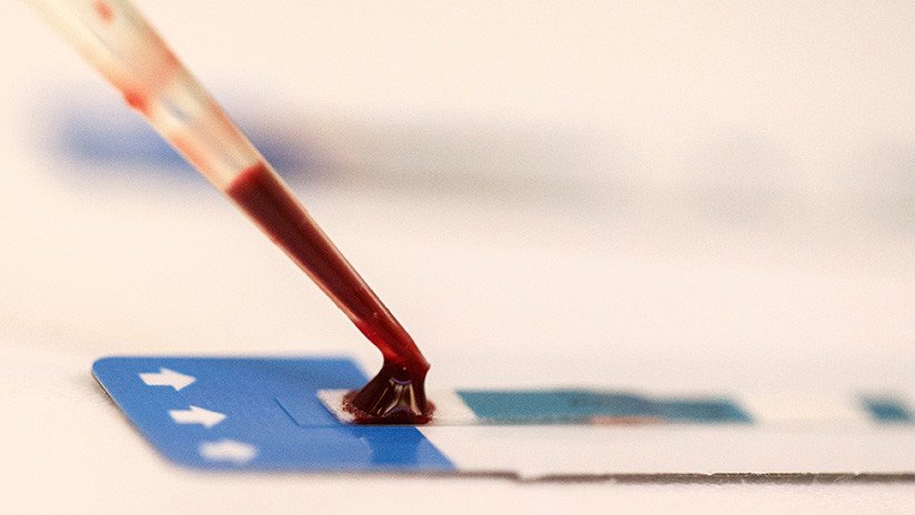 Un tercer paciente se habría curado del VIH después de un trasplante de médula ósea