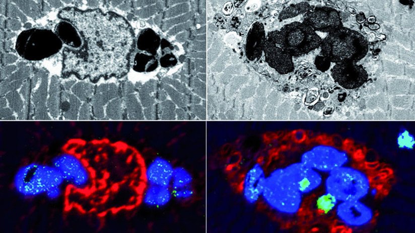 Descubren una nueva enfermedad en familias europeas que afecta a los músculos y de momento no tiene cura