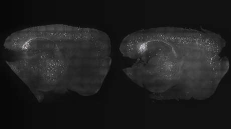 ¿Podrían la luz y el sonido curar el alzhéimer? Un experimento con ratones sugiere un potencial prometedor