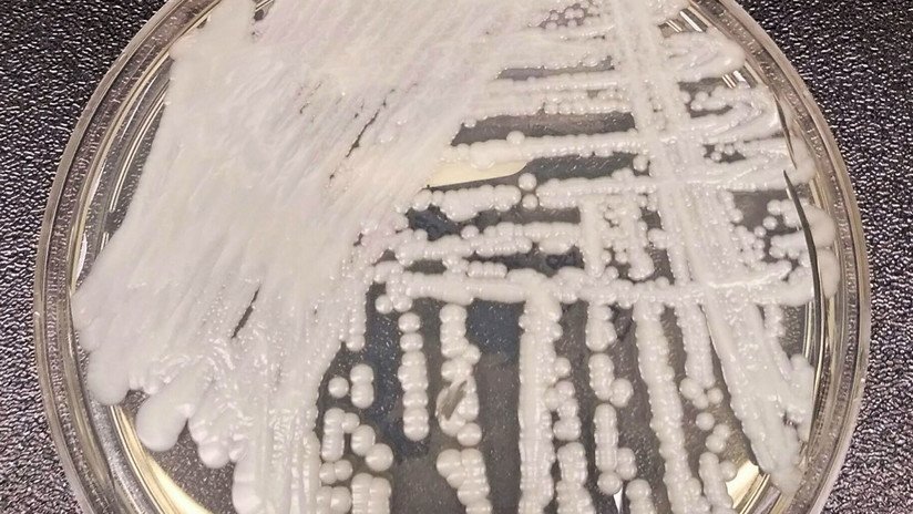 Qué es el peligroso hongo 'Candida auris', que ya ha sido detectado en 32 países