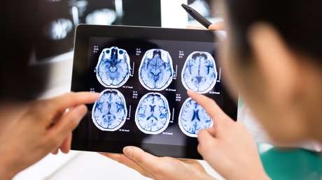 FOTOS: Un joven sobrevive milagrosamente luego de que una barra de hierro le atravesara la cabeza