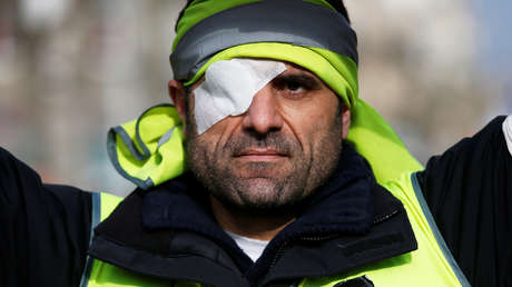 Los 'chalecos amarillos' que resultaron heridos graves crean una asociación para combatir la brutalidad policial