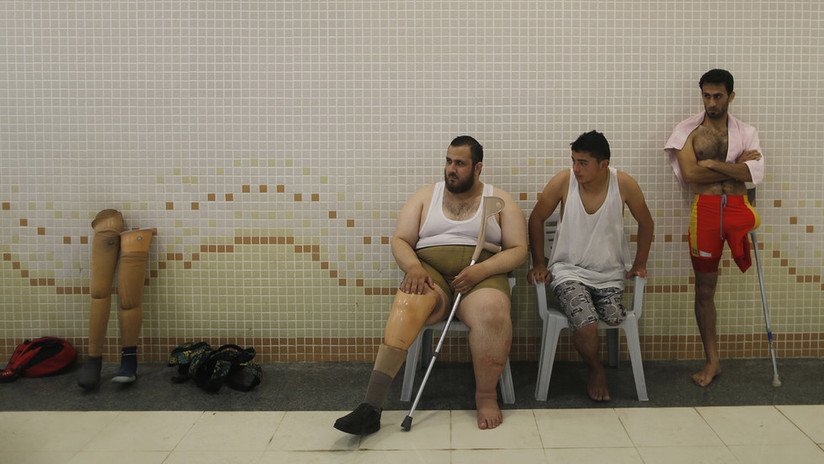 ONU: 1.700 palestinos heridos por las fuerzas israelíes podrían ser amputados por falta de fondos