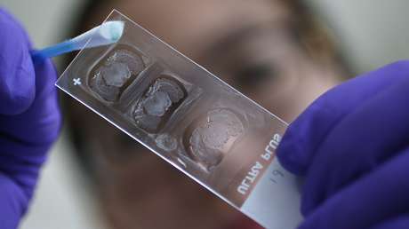 Desarrollan en Brasil un mecanismo para revertir los efectos de la sobredosis de cocaína