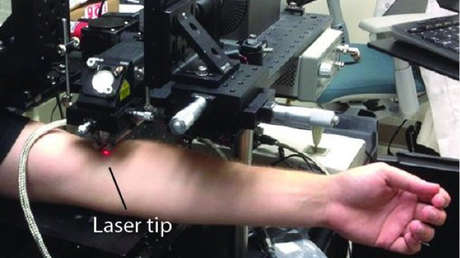 Científicos crean un láser capaz de detectar y destruir células cancerosas