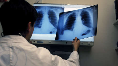 Acude a un hospital por tos y descubre que tiene todos sus órganos invertidos