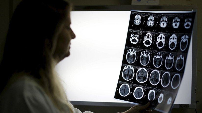 Científicos descubren dos 'recetas' para frenar el envejecimiento del cerebro