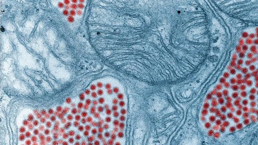 Detectan en Florida un raro virus capaz de provocar daños cerebrales