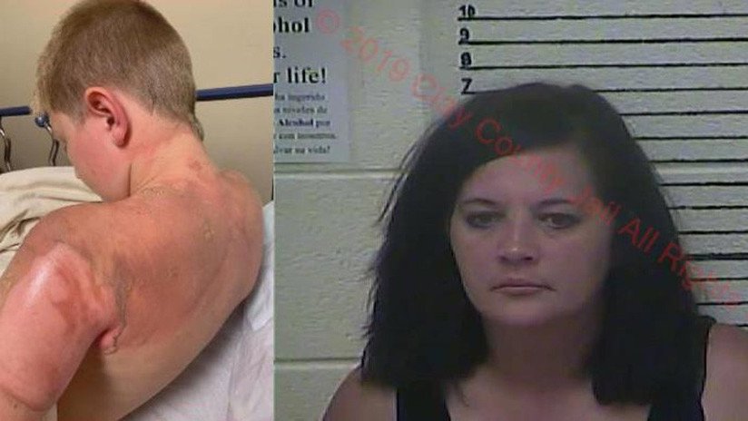 Un niño vierte agua hirviendo sobre un amigo para un desafío viral y detienen a su madre por no buscar ayuda