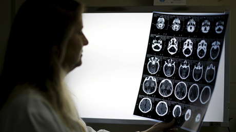 Científicos descubren dos 'recetas' para frenar el envejecimiento del cerebro