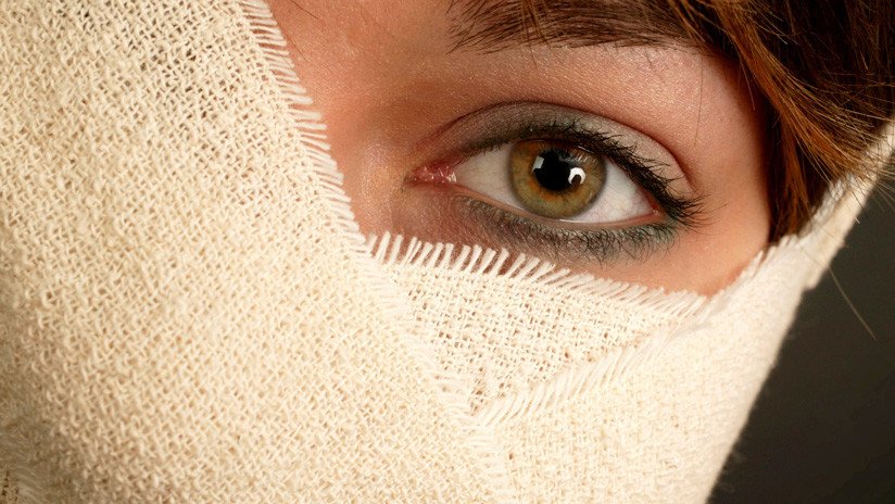 "Espero que nadie más lo haga": una joven se queda ciega de un ojo tras explotarle dos huevos hervidos en microondas