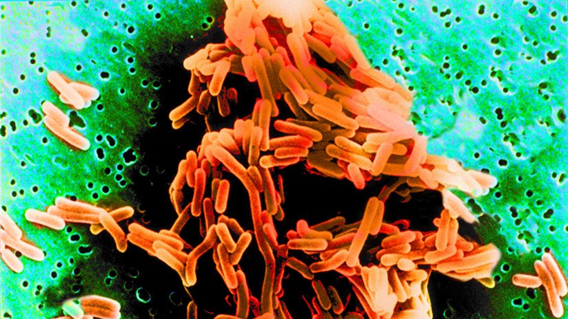 Político español a una mujer que sufrió un abortó por el brote de listeriosis: "Para el próximo embarazo nos hacemos una foto"