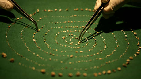 Extraen más de 500 dientes a un niño indio de 7 años