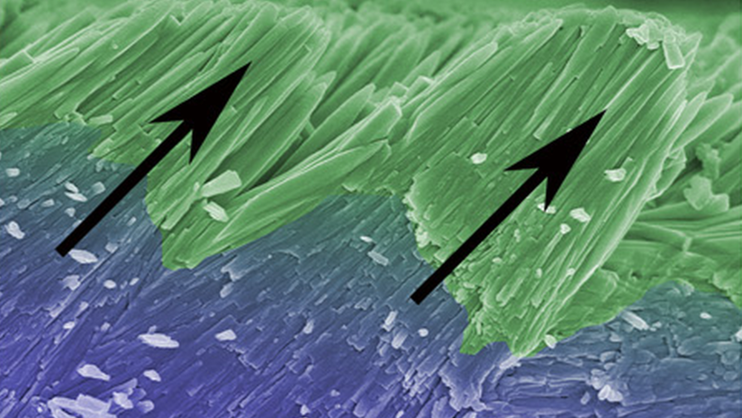 Desarrollan un método para recrear el esmalte que haría innecesarios los empastes